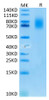 Recombinant Human TNFRSF8/CD30 Protein (RPCB0672)