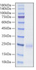 Recombinant Human BY55/CD160 Protein (RPCB0675)