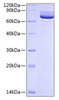 Recombinant Rat 5'-Nucleotidase/NT5E/CD73 Protein (RPCB0676)