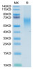 Recombinant Human B7-1/CD80 Protein (RPCB0698)