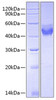 Recombinant Mouse Thymic stromal lymphopoietin/TSLP Protein (RPCB0703)