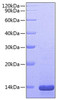 Recombinant Mouse Beta-nerve growth factor/NGFB Protein (RPCB0715)