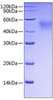 Recombinant Mouse Fc gamma RI/FCGR1/CD64 Protein (RPCB0717)