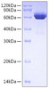 Recombinant Human Tissue-type plasminogen activator/TPA/PLAT Protein (RPCB0722)