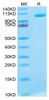 Biotinylated Recombinant Human MMP-9 Protein (RPCB0731)