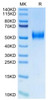 Biotinylated Recombinant Human uPAR/PLAUR/CD87 Protein (RPCB0733)