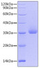 Recombinant Human Kallikrein-4/KLK4 Protein (RPCB0734)