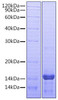 Recombinant Human Amphiregulin/AREG Protein (RPCB0735)