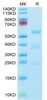Biotinylated Recombinant Human uPA/PLAU Protein (RPCB0739)