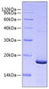 Recombinant Mouse Pleiotrophin/PTN Protein (RPCB0758)