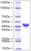 Recombinant Human DPEP1 Protein (RPCB0762)