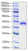 Recombinant Human S100-B Protein (RPCB0764)