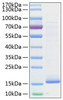 Recombinant Human Cystatin-D/CST5 Protein (RPCB0767)