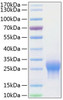 Recombinant Human ALK-1/ACVRL1 Protein (RPCB0774)