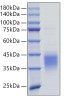 Recombinant Mouse TNFSF9/4-1BB Ligand Protein (RPCB0775)