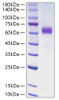 Recombinant Human Jagged1/JAG1/CD339 Protein (RPCB0776)
