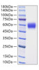 Recombinant Human Serpin B3/SCCA-1 Protein (RPCB0777)