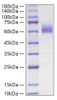 Recombinant Mouse CD47 Protein (RPCB0780)