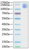 Recombinant Human CEACAM5/CEA/CD66e Protein (RPCB0782)