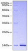 Recombinant Human Estrogen receptor/ESR1 Protein (RPCB0786)