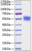Recombinant Human BTLA/CD272 Protein (RPCB0788)