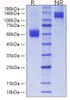 Recombinant Mouse CD28 Protein (RPCB0811)