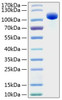 Recombinant Human EphB4/HTK Protein (RPCB0813)