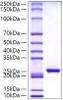 Recombinant Human C-Reactive Protein/CRP Protein (RPCB0817)