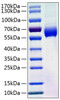 Recombinant Human Angiotensinogen/AGT Protein (RPCB0818)