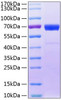 Recombinant Human IL-20RB Protein (RPCB0824)