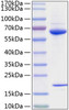 Recombinant Human PCSK9 Protein (RPCB0829)