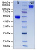 Recombinant Human CD8a Protein (RPCB0831)