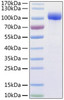 Recombinant Human ACE-2 Protein (RPCB0844)