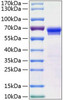 Recombinant Human JAM-B/VE-JAM/CD322 Protein (RPCB0847)