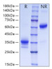 Recombinant Human LOX-1/OLR1 Protein (RPCB0848)