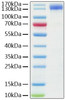 Recombinant Human ACE-2 Protein (RPCB0856)