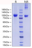 Recombinant Mouse MMP-9 Protein (RPCB0861)