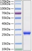 Recombinant Rat Lipocalin-2/NGAL/LCN2 Protein (RPCB0862)