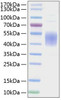 Recombinant Mouse B7-1/CD80 Protein (RPCB0863)