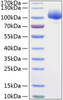 Recombinant Human FGFR-1/FLT-2/CD331 Protein (RPCB0871)