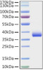 Recombinant SARS-COV-2 Spike RBD(E484K) Protein (RPCB0880)