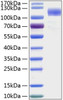 Recombinant Human Siglec-5/CD170 Protein (RPCB0886)