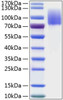 Recombinant Human MERTK Protein (RPCB0887)