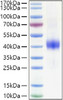 Recombinant Mouse Dkk-1 Protein (RPCB0897)
