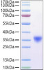 Recombinant Mouse Fc-gamma RIV/FCGR3A/CD16a Protein (RPCB0909)