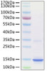 Recombinant Human S100-A9 Protein (RPCB0914)