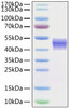 Recombinant Human IL-12B/IL-12 p40 Protein (RPCB0915)