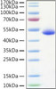 Recombinant Human TNFRSF10B/DR5/TRAIL-R2/CD262 Protein (RPCB0916)