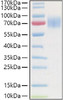 Recombinant Human Guanylyl cyclase C/GUCY2C Protein (RPCB0918)