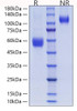 Recombinant Human ICOS/CD278 Protein (RPCB0920)